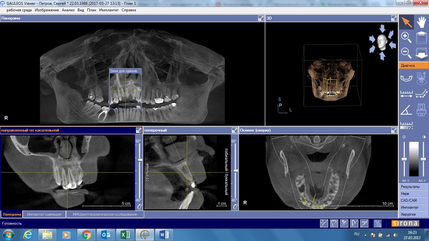 Such teeth are removed or going to the dentist - My, Dentistry, , Teeth, Pain, , Help, The medicine, Doctors