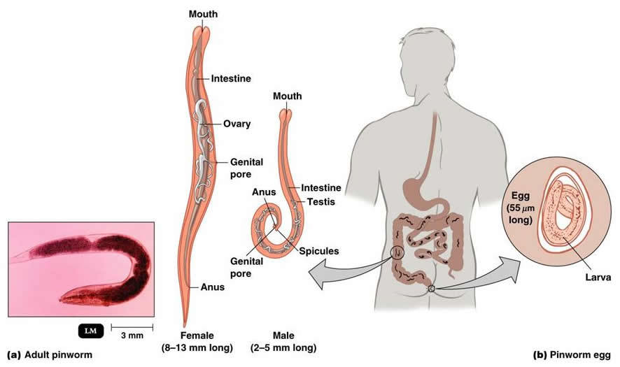 Ascariasis in children - The medicine, Ascariasis, Disease, Roundworm, Images, Text, Longpost