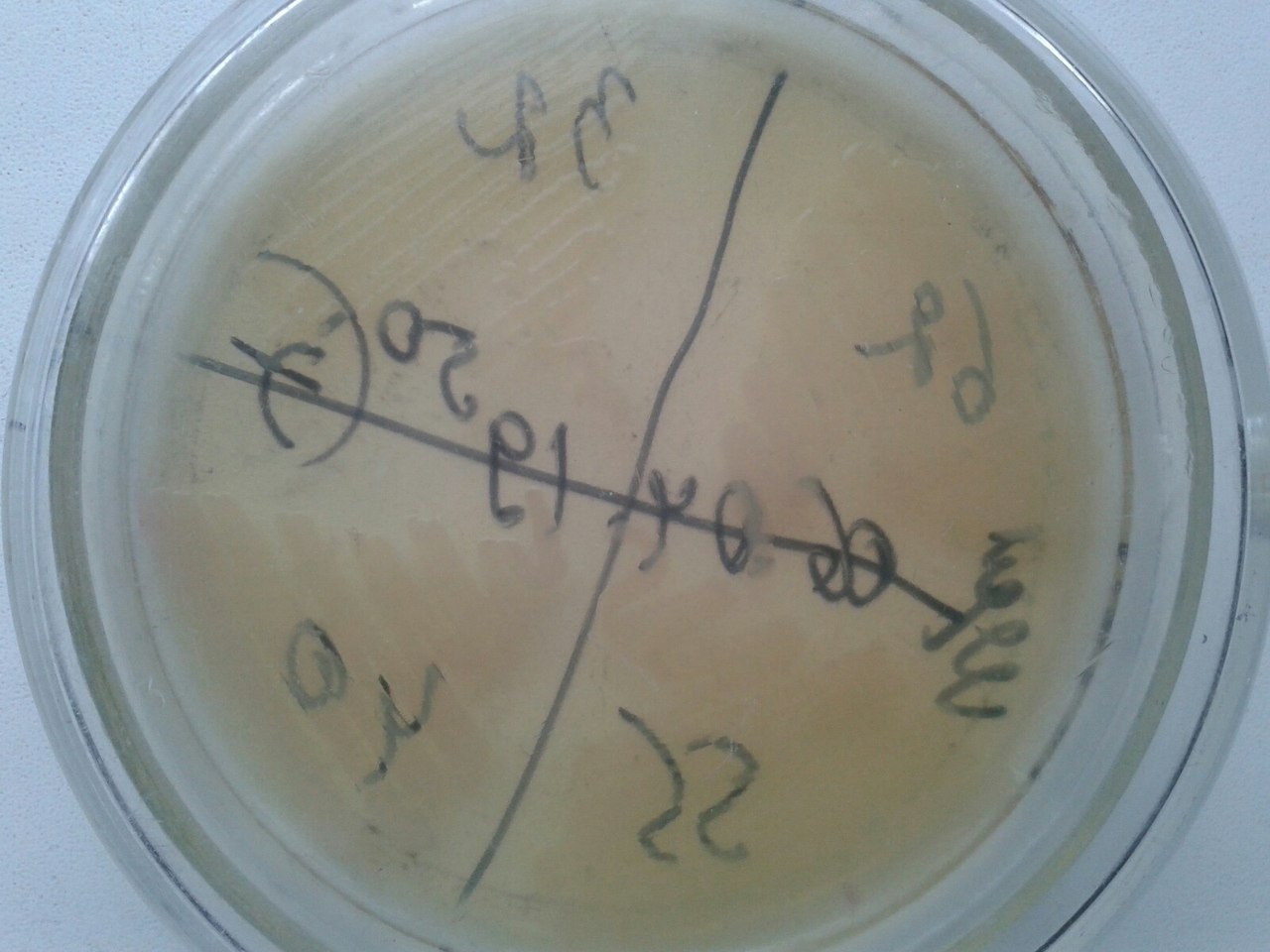 Some cultures of microbacteria - The medicine, Microbiology, Bacteria, Agario, Environment, Images, Longpost
