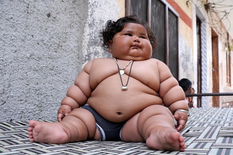 8-month-old girl weighs 17 kilograms, and continues to get fat - Children, Parents, Fatty, Excess weight, Upbringing, India, Girl, Food, Longpost