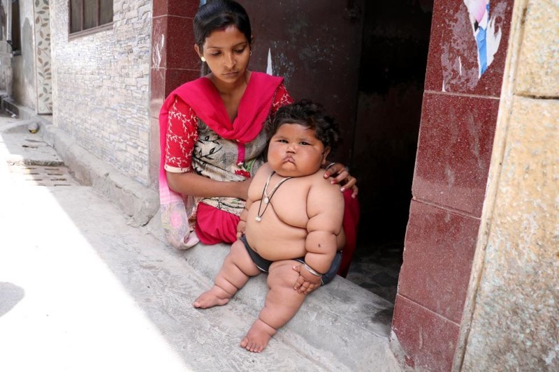 8-month-old girl weighs 17 kilograms, and continues to get fat - Children, Parents, Fatty, Excess weight, Upbringing, India, Girl, Food, Longpost