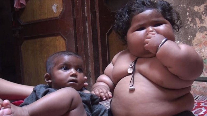 8-month-old girl weighs 17 kilograms, and continues to get fat - Children, Parents, Fatty, Excess weight, Upbringing, India, Girl, Food, Longpost