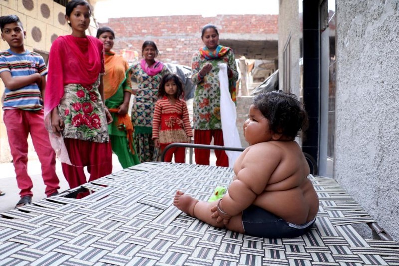 8-month-old girl weighs 17 kilograms, and continues to get fat - Children, Parents, Fatty, Excess weight, Upbringing, India, Girl, Food, Longpost