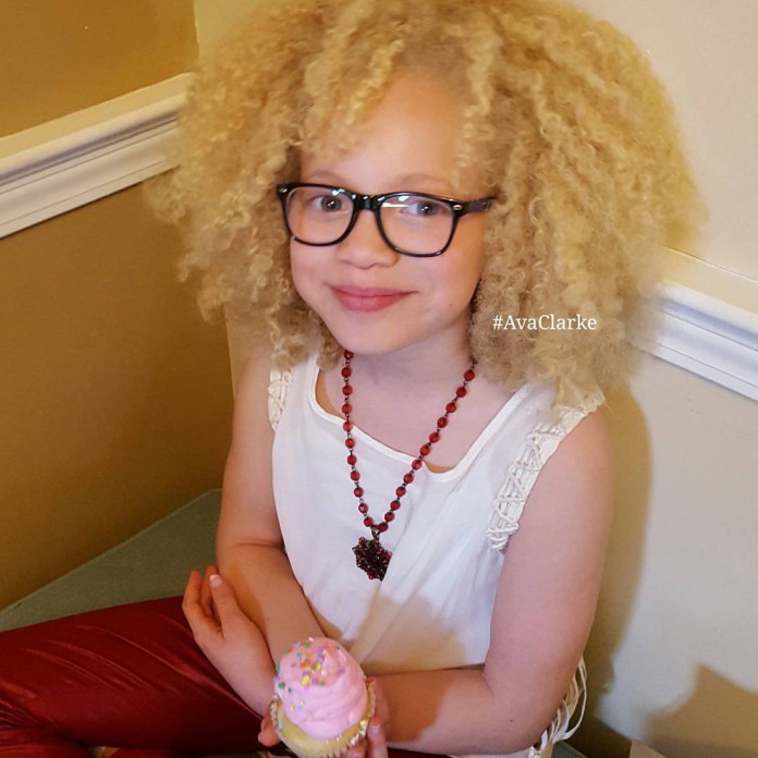 Ava Clarke is an albino African American. - , Children, Albino, Blonde, Black people, Models, Unusual, Interesting, Longpost