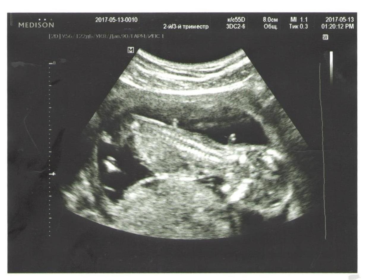 We will have ..... a pelican? - My, Ultrasound, The photo