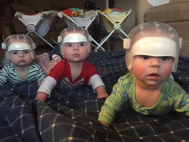 One in 500 trillion chance: why are these triplets wearing special helmets? - Children, Parents, Chance, Help, Health, Triplets, Helmet, Disease, Longpost