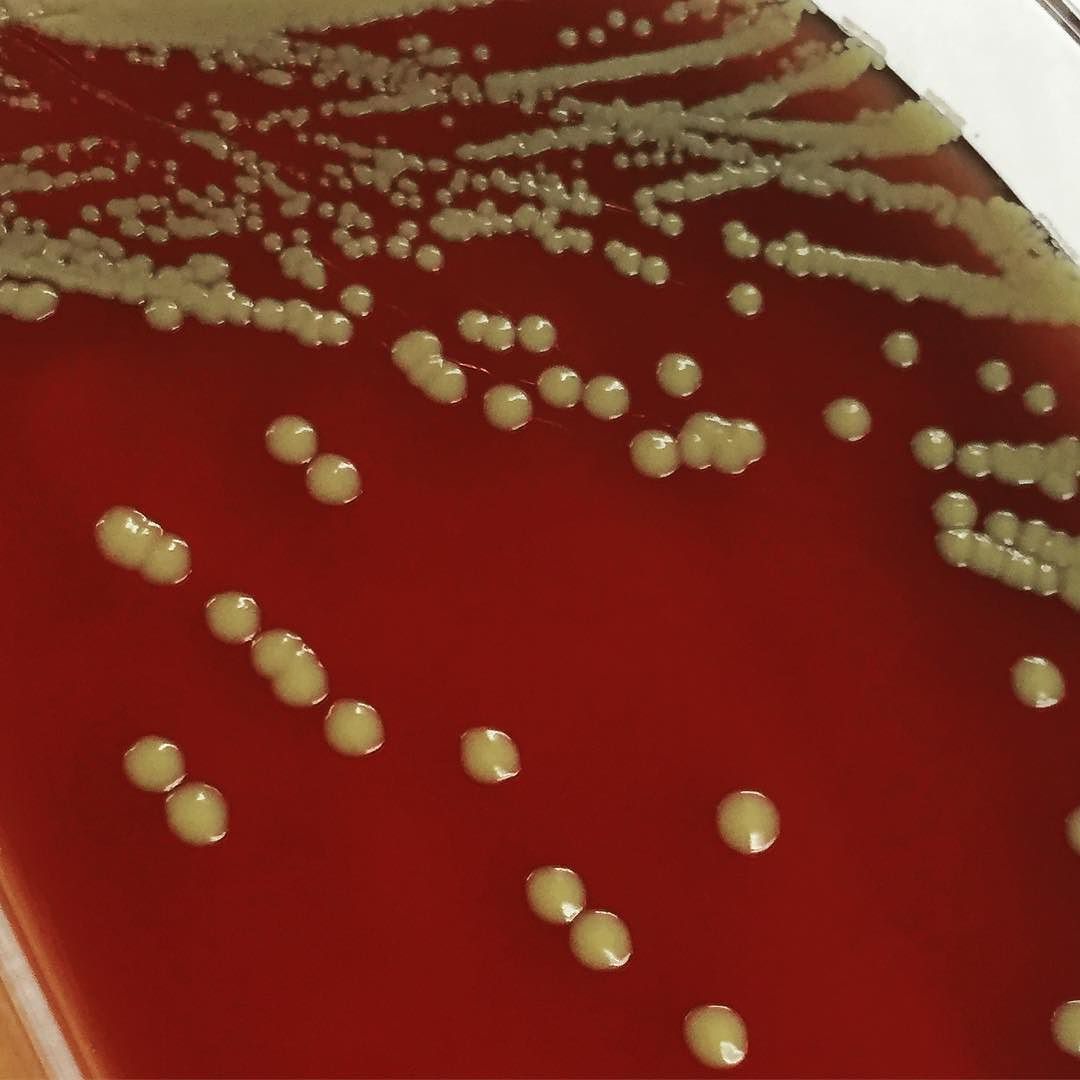 Streptococcus Viridans на кровяном агаре