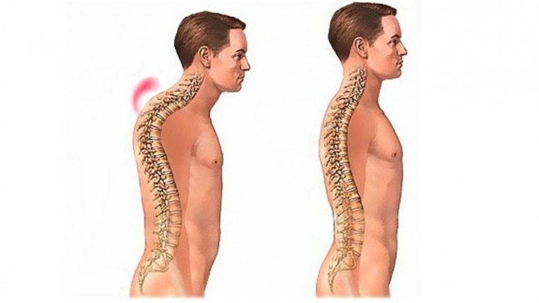 Thoracic kyphosis test - My, Sport, Physical Education, Тренер, Training program, Kyphosis, Sports Tips, Longpost