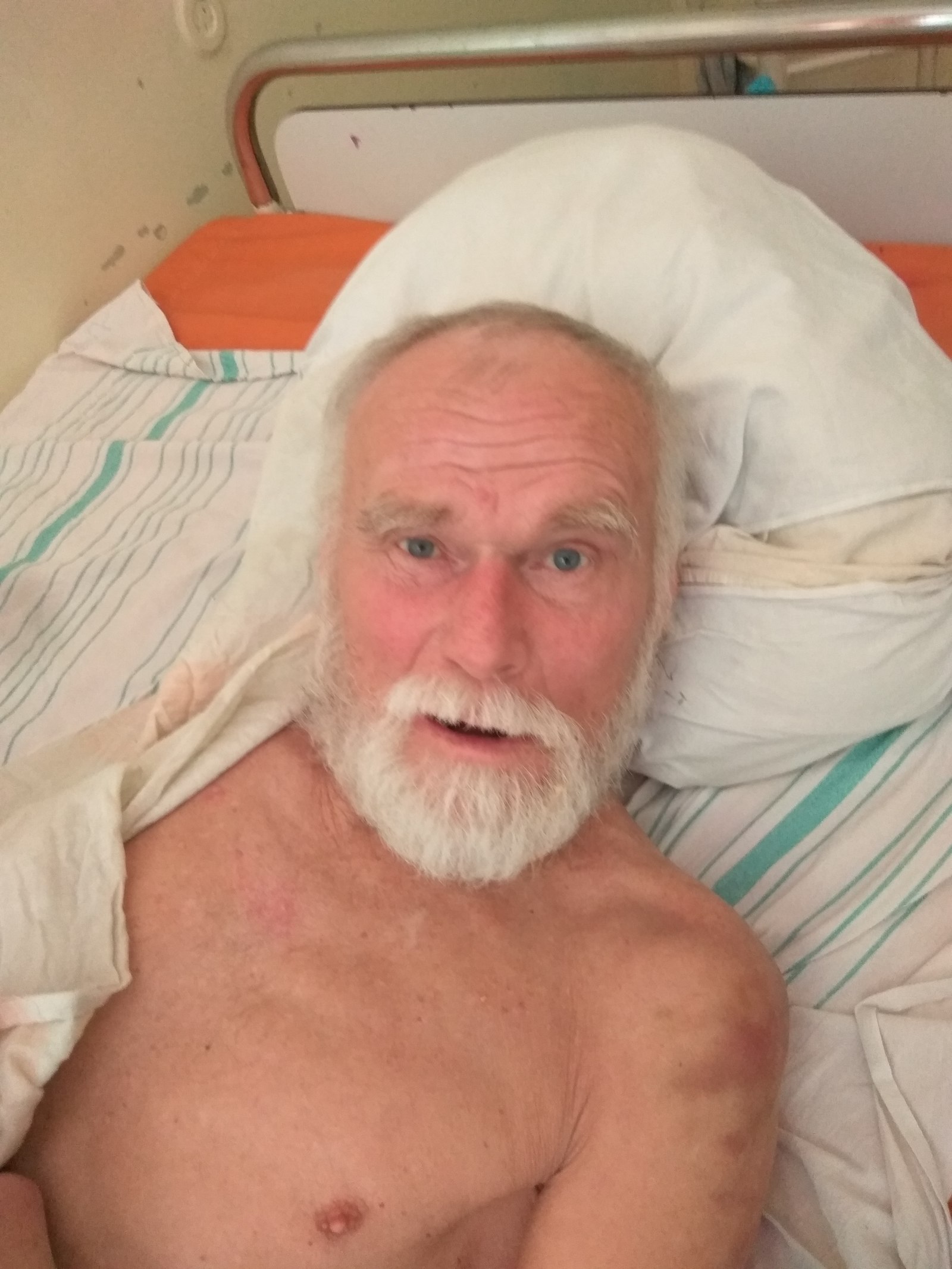 Lost / found a man, Zaporozhye - Help, Missing person, Zaporizhzhia, Stroke, , People search