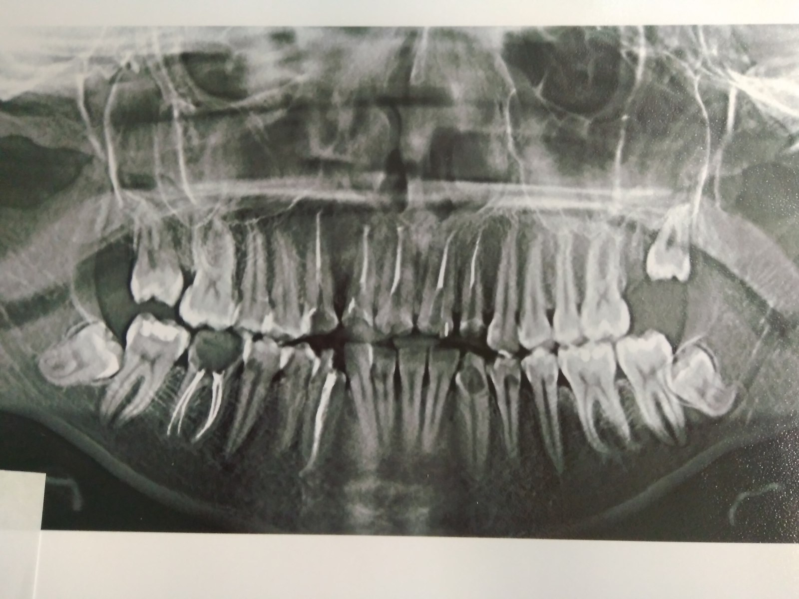 And again about the teeth (remnants of unnoticed information) - My, Dentistry, Teeth, Treatment, Information, Minsk, Longpost