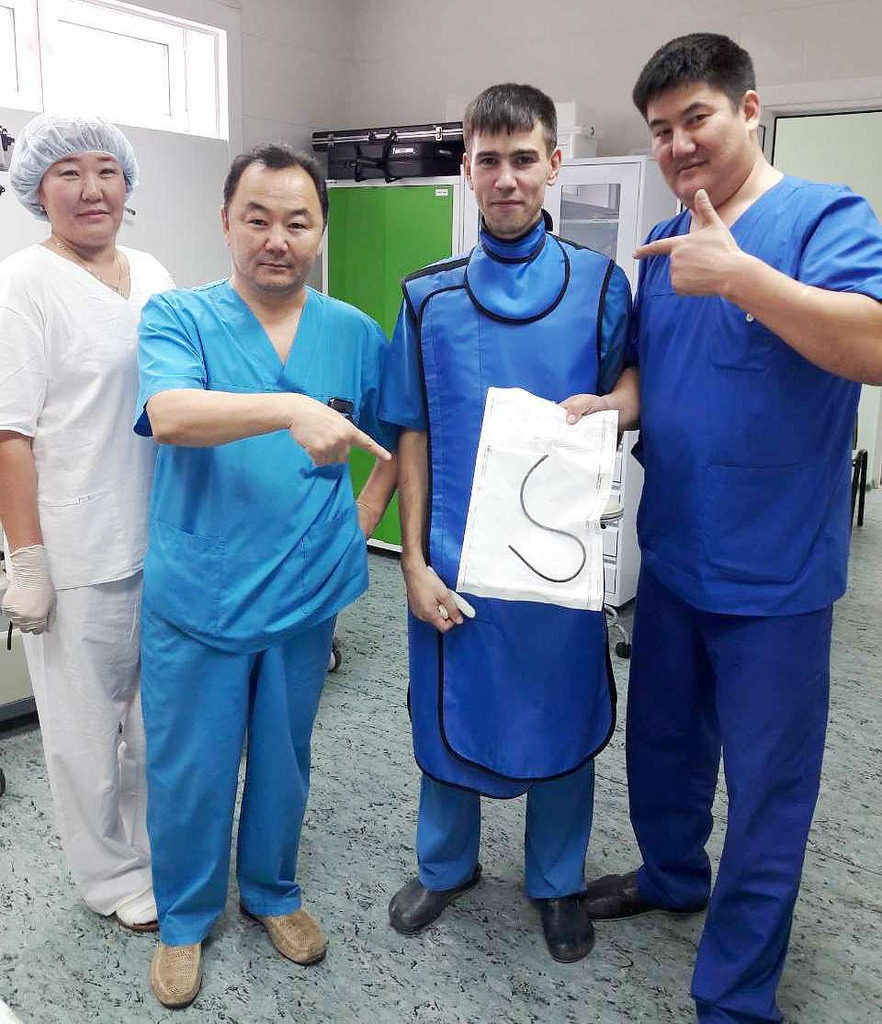 Ulan-Udenka lived for 17 years with a 30-cm tube in her stomach. - A tube, Polyclinic, 17 years, Ulan-Ude, Longpost, news, Amazing