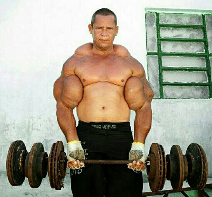 Synthol is used by everyone - Synthol, Body-building, Freaks, Ifbb, Longpost