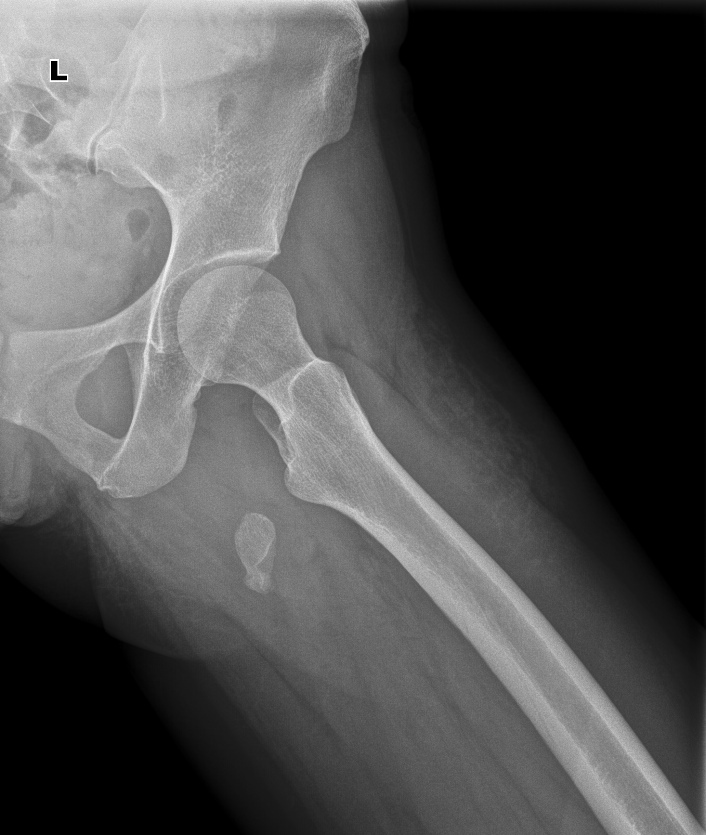 From the life of a radiologist. Part 6 - My, X-ray, X-rays, The medicine, Longpost