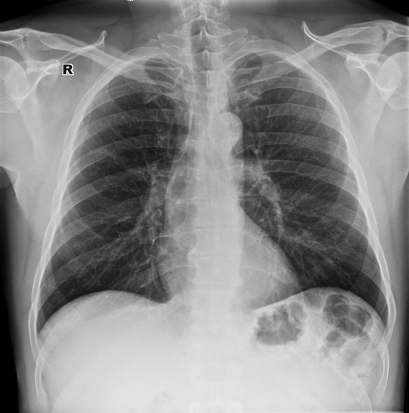 From the life of a radiologist. Part 6 - My, X-ray, X-rays, The medicine, Longpost