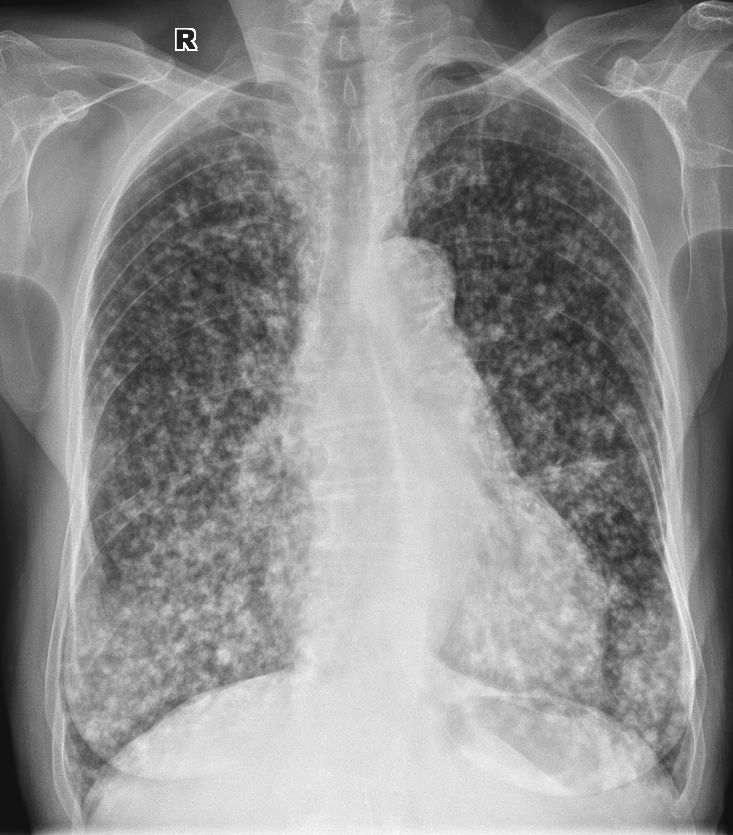 From the life of a radiologist. Part 6 - My, X-ray, X-rays, The medicine, Longpost