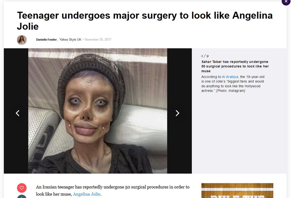 Turning into a lich is a difficult procedure - Plastic surgery, Lich, Angelina Jolie, Freak, Tags are clearly not mine, Freaks