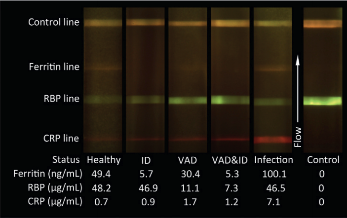 Test strip detects iron and vitamin A deficiency in 15 minutes - The science, news, The medicine, Deficit, IT, Technologies, Test