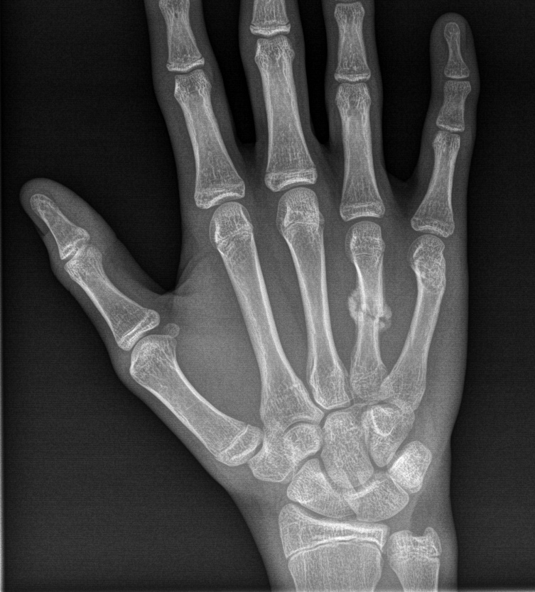 From the life of a radiologist. Part 9 - My, X-ray, The medicine, Longpost