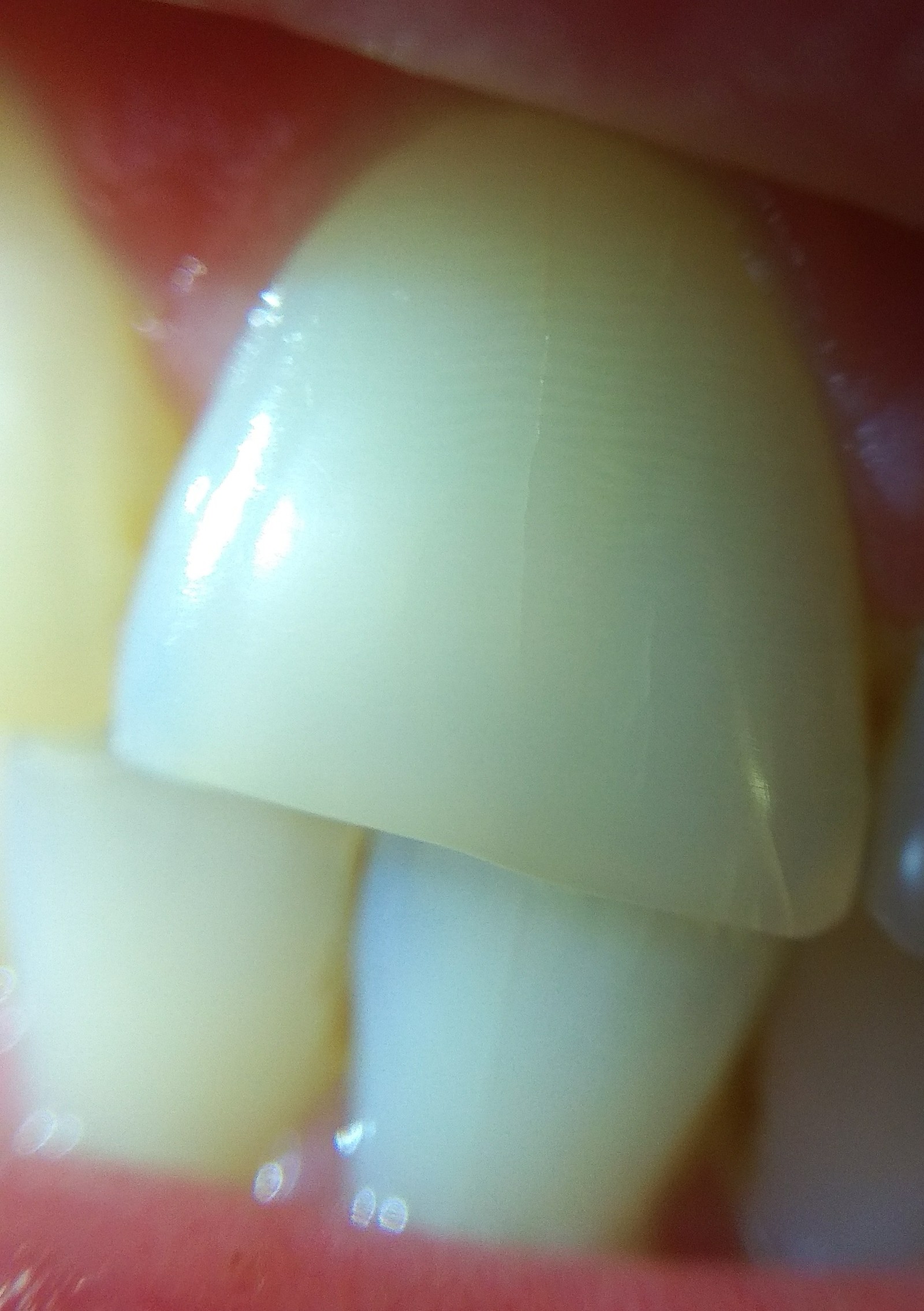 When the macro lens came from Alik. - My, Chinese goods, Teeth