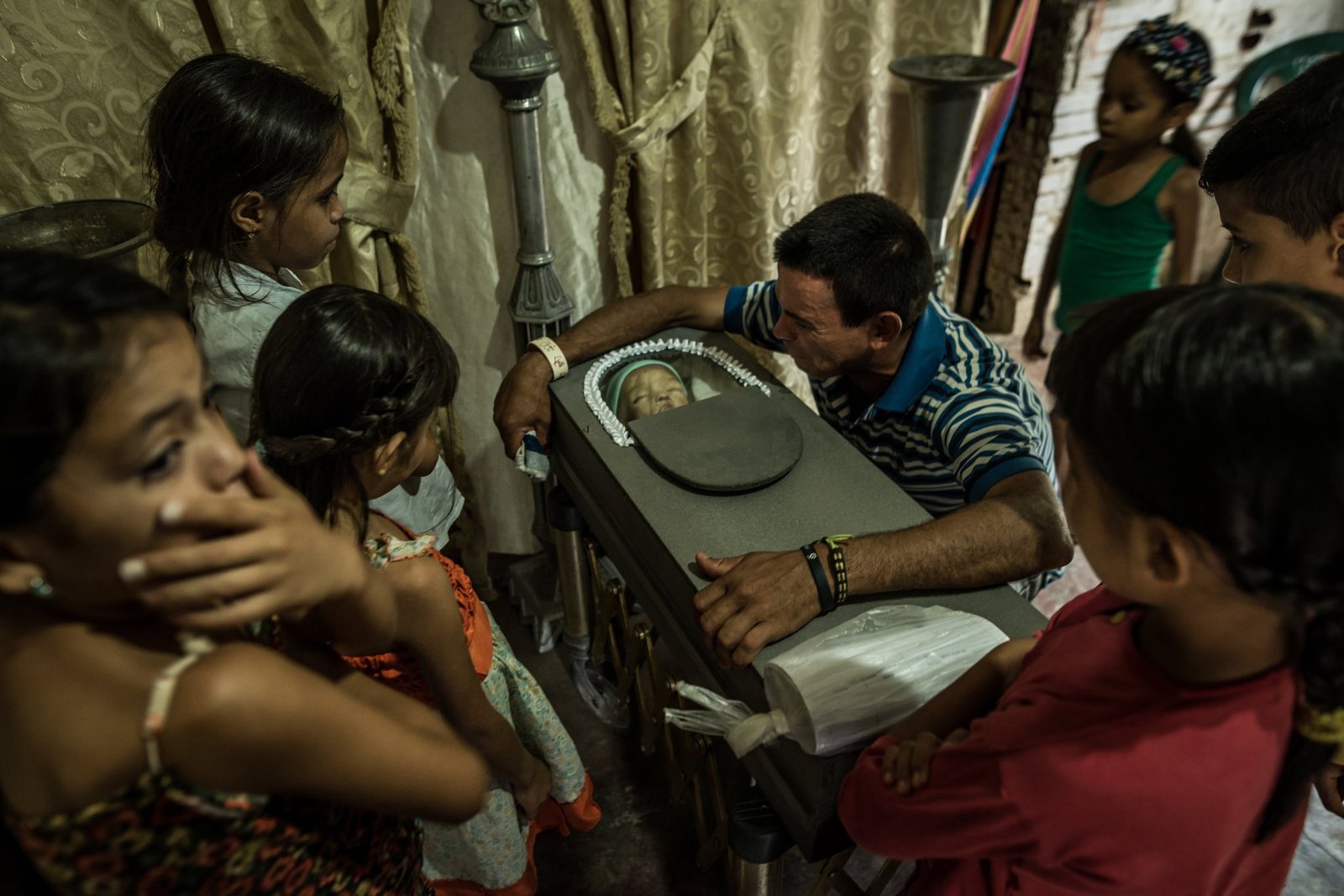 Starving Venezuelan children. - Venezuela, Hunger, The medicine, Nutrition, Socialism, Children, A crisis, , Longpost