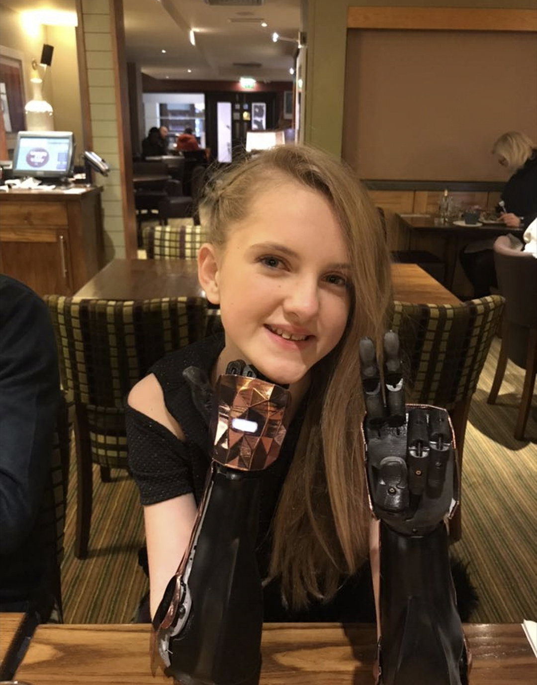 Tilly lost her arms as a child. Now she's bionic. - Deus Ex, Prosthesis, Bionics, Disabled person