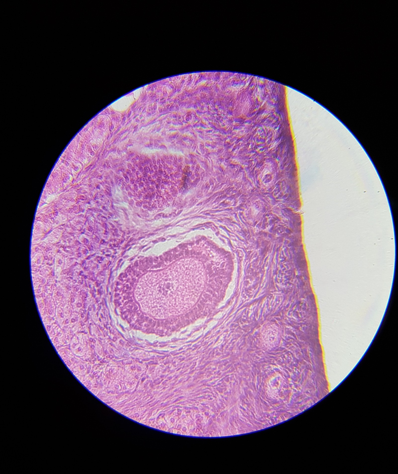 Яйца власоглава под микроскопом фото