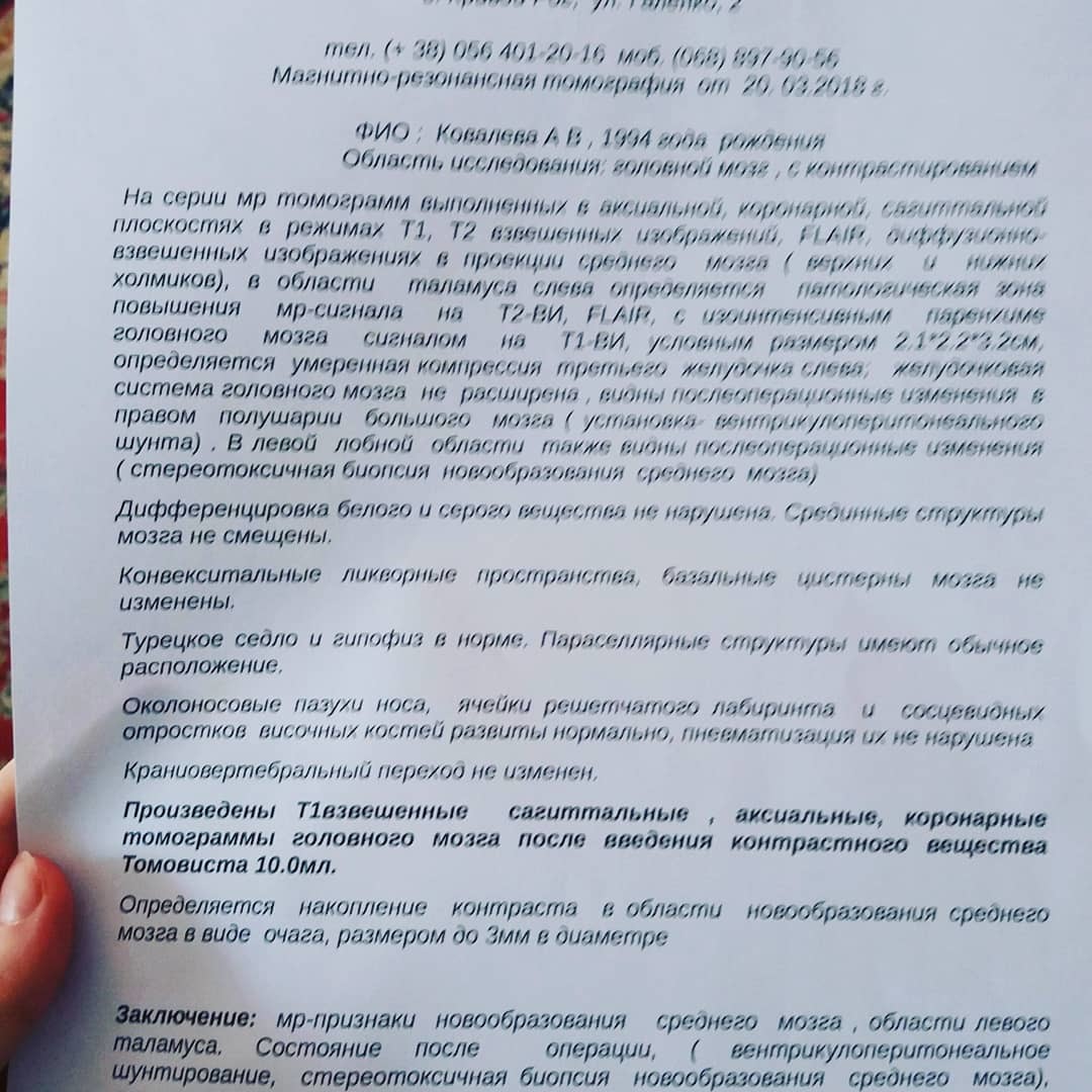 Нужен совет, нейроонколог - Моё, Нейроонколог, Астроцитома, Онкология, МРТ, Рак мозга, Опухоль головного мозга, Рак, Онколог, Длиннопост