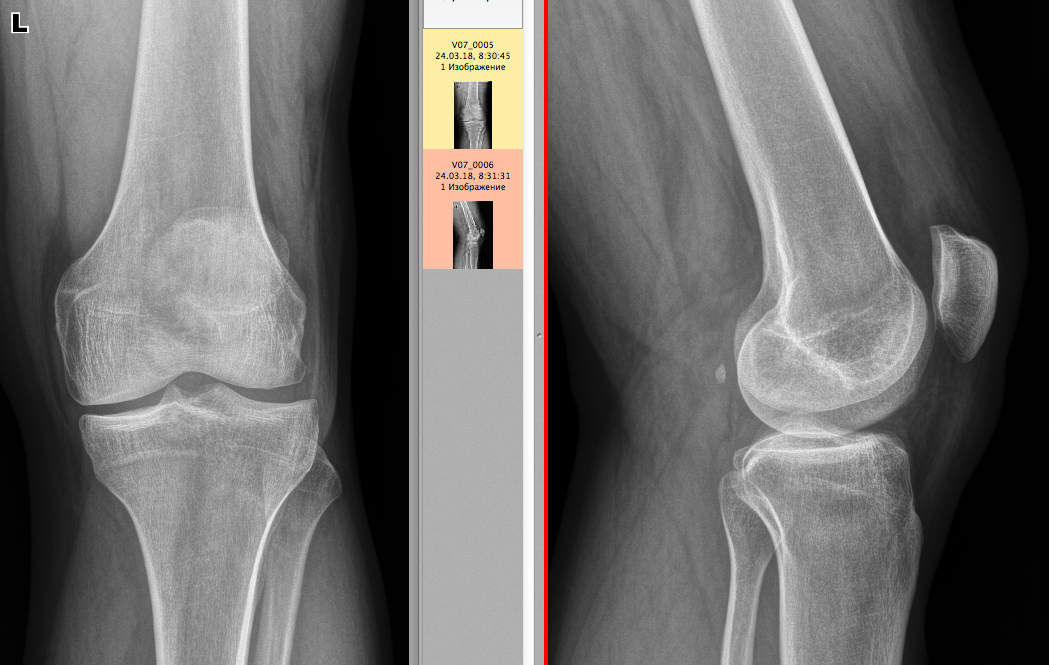 From the life of a radiologist. Part 18 - My, X-ray, The medicine, Longpost