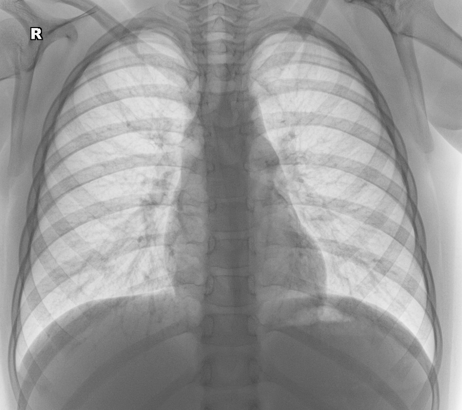 From the life of a radiologist. Part 19 - My, X-ray, The medicine, Longpost, The photo