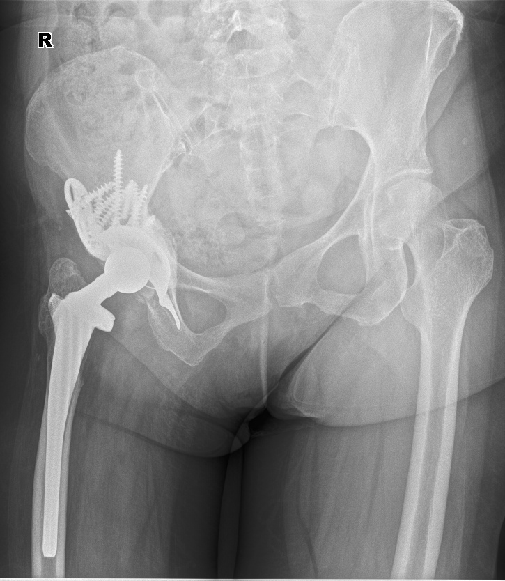 From the life of a radiologist. Part 19 - My, X-ray, The medicine, Longpost, The photo