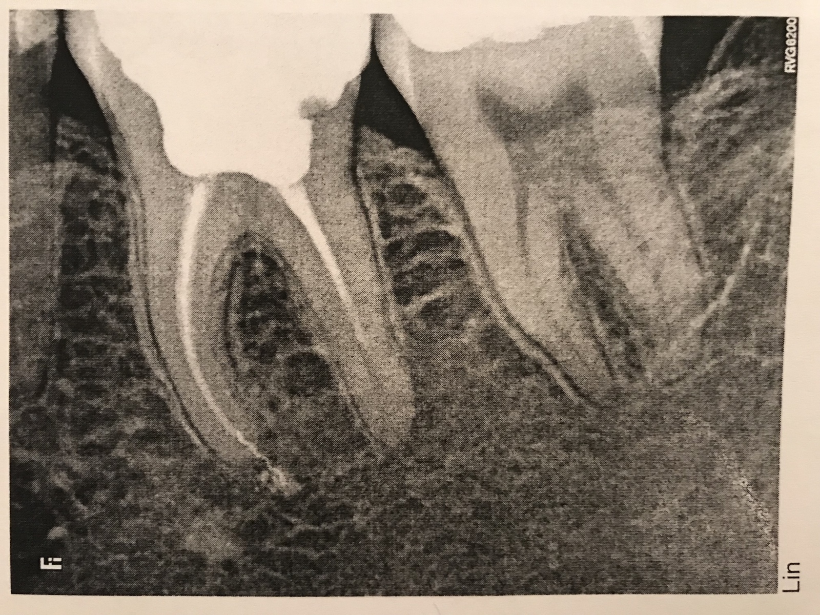 Insidious 36 - My, Teeth, Diagnosis, Moscow