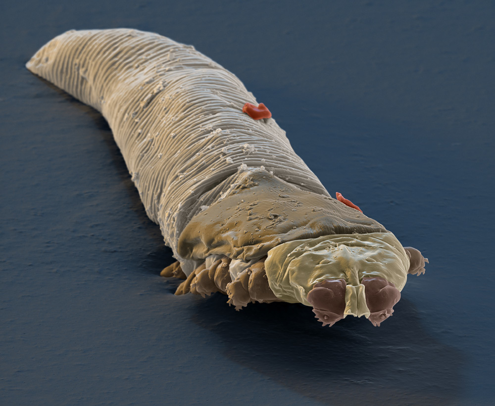 paraziti zadah iz usta reason for papilloma