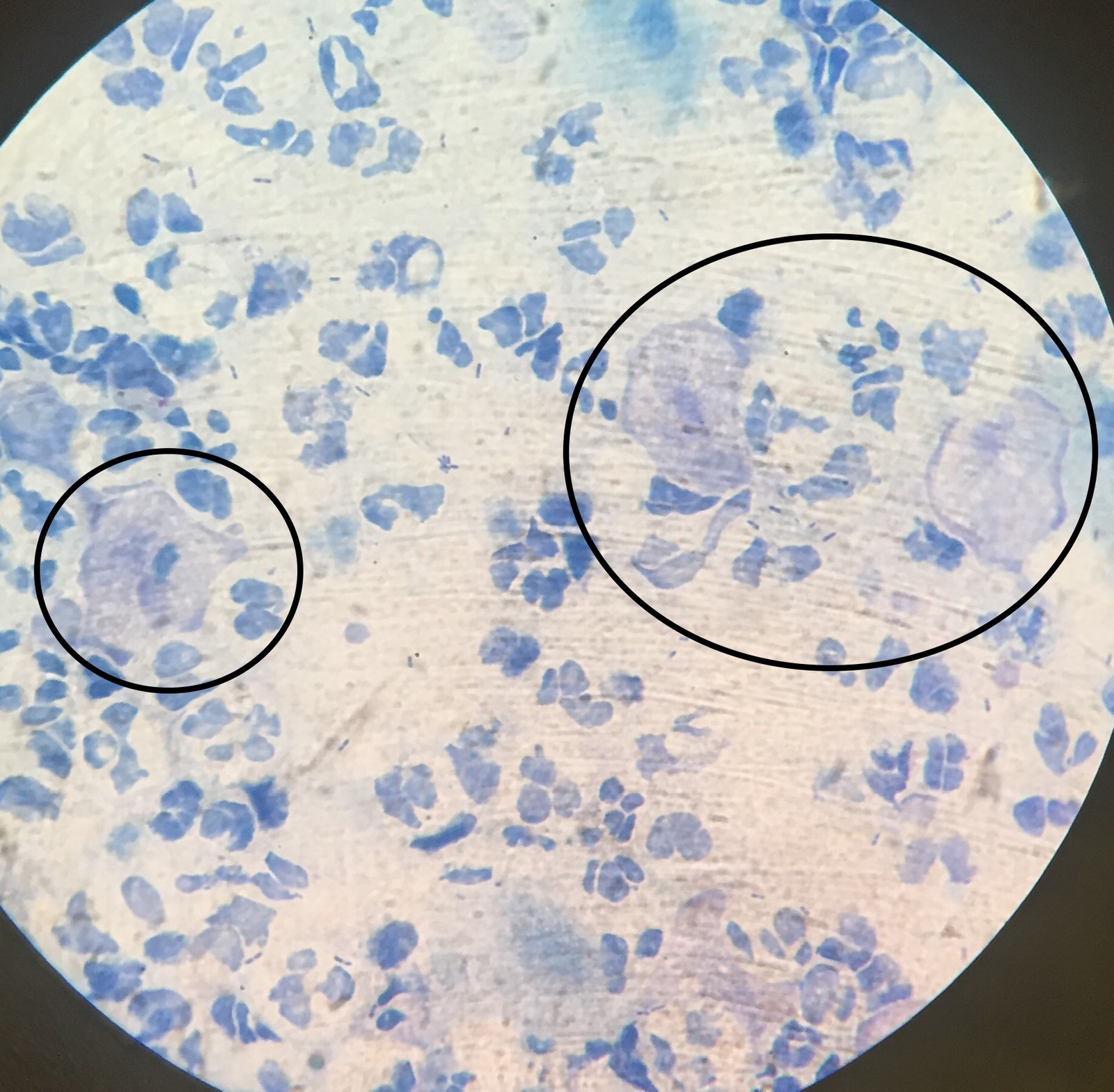 Цвель. Трихомонада метиленовый синий. Трихомонады микроскопия нативный препарат. Трихомонада микроскопия метиленовый синий. Трихомонада микроскопия.