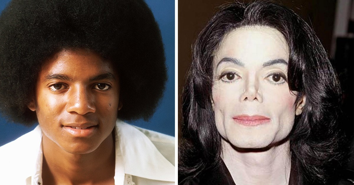 Что на самом деле делал со своим лицом Майкл Джексон? — Michael Jackson is INNOCENT