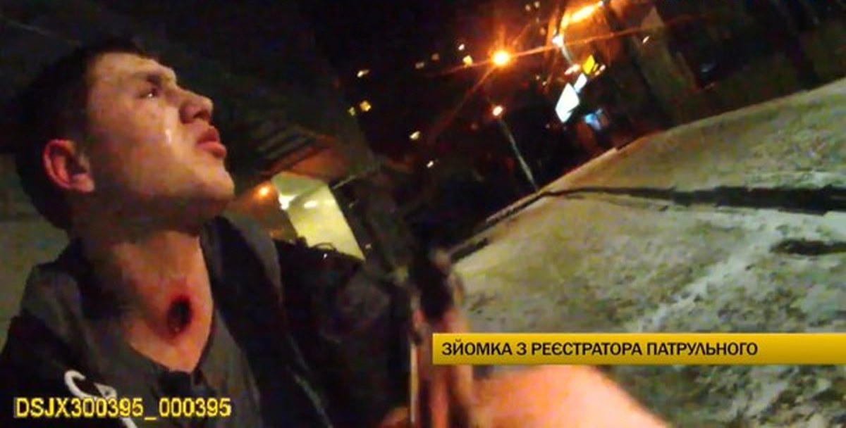 Фото С Травматического Пистолета В Голову