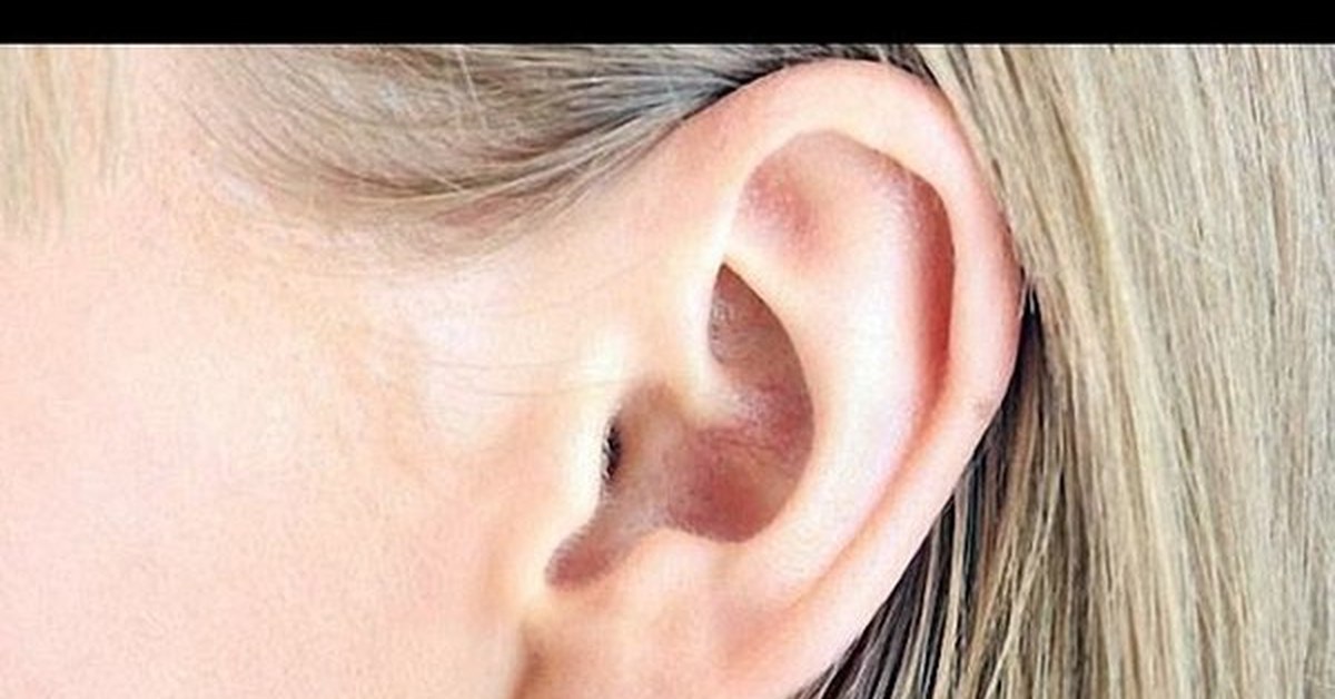 Две ушные раковины. Ухо. Что такое белое шелушение в ушах. Шелушение в ушной раковине.
